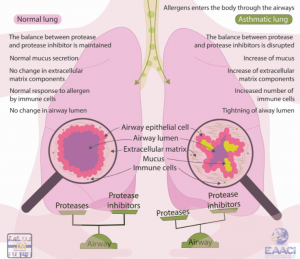 Understanding the airway remodeling in asthma and its main elements ...